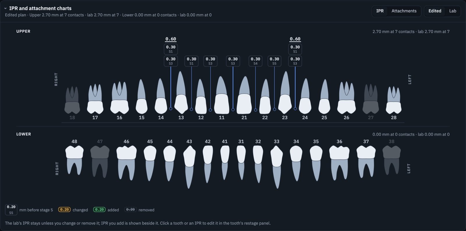 IPR and attachment chart for both arches, showing the amount and stage of IPR at each contact