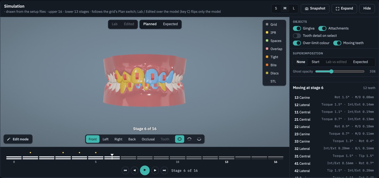 3D simulation, front view at stage 6, with moving teeth coloured