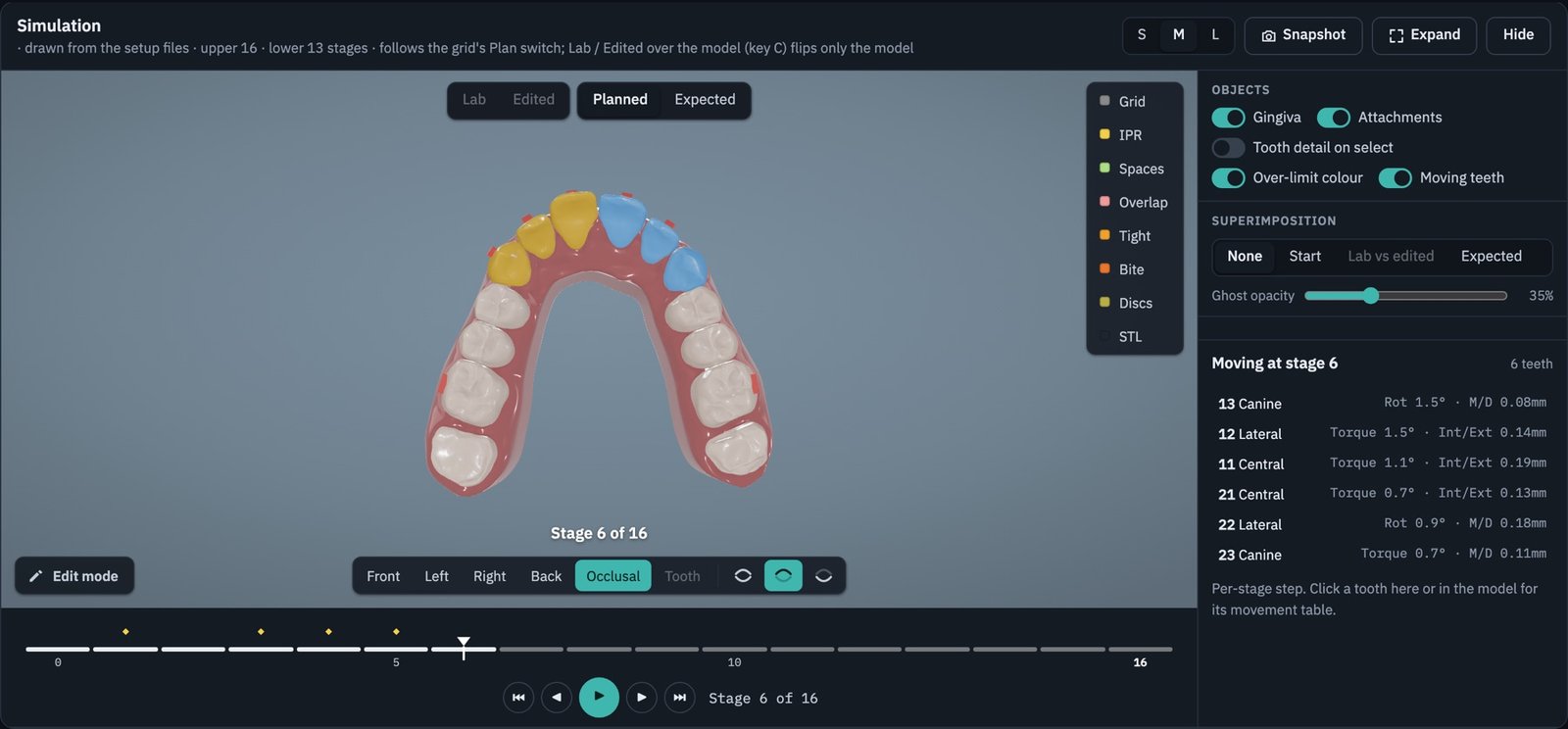 3D simulation, upper occlusal view at stage 6